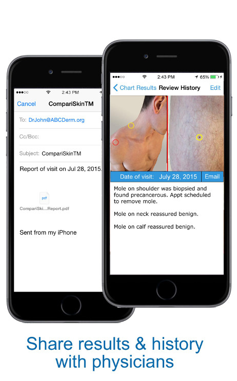 Share Results & History with Transitions - skin mapping with Compariskin